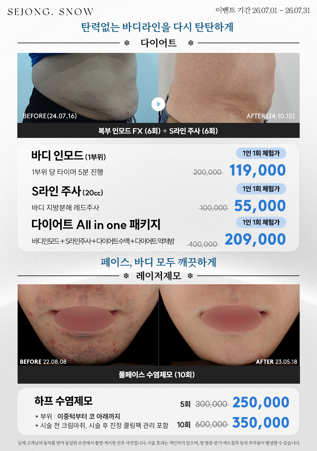 다이어트/레이저제모