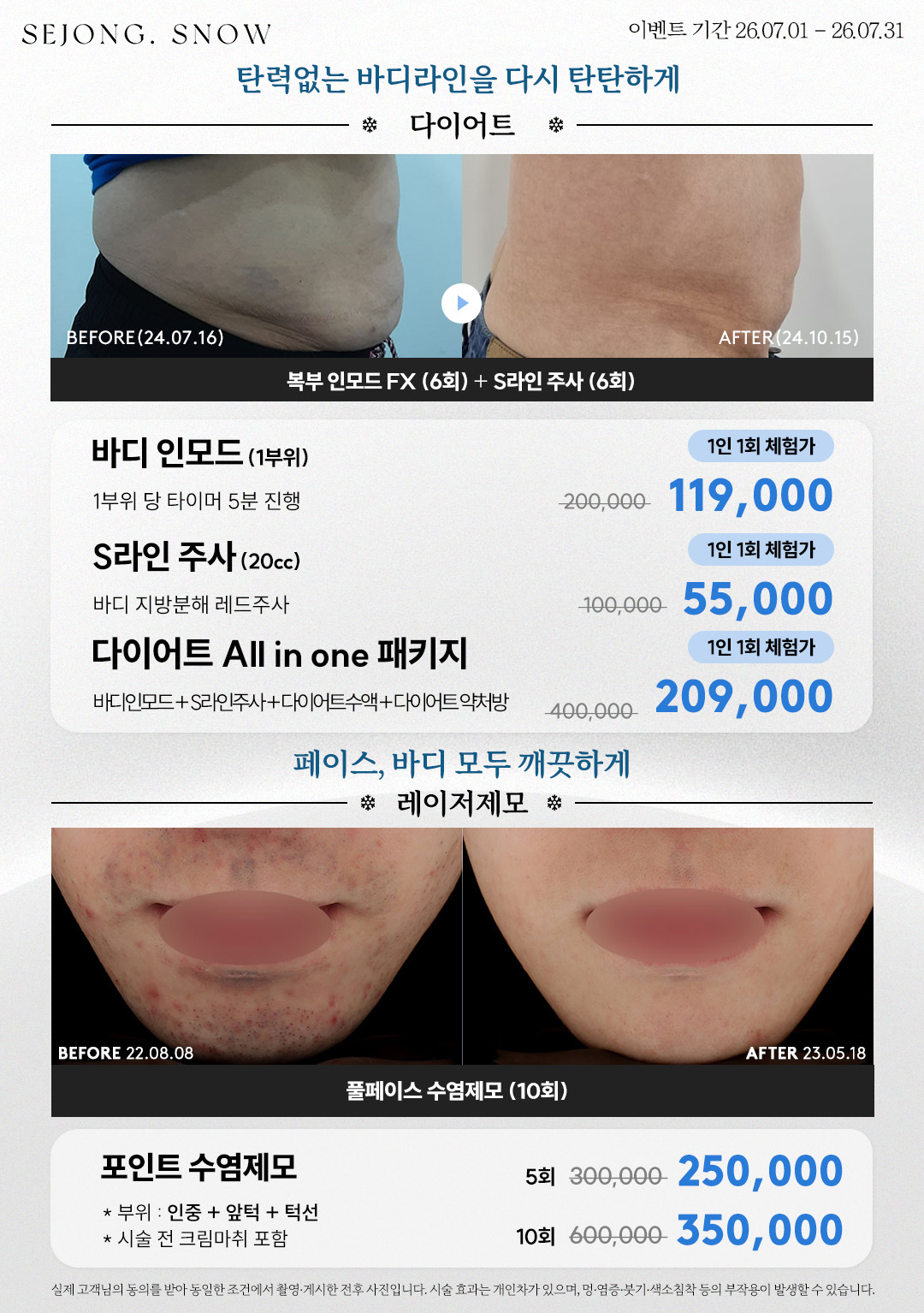 다이어트/레이저제모